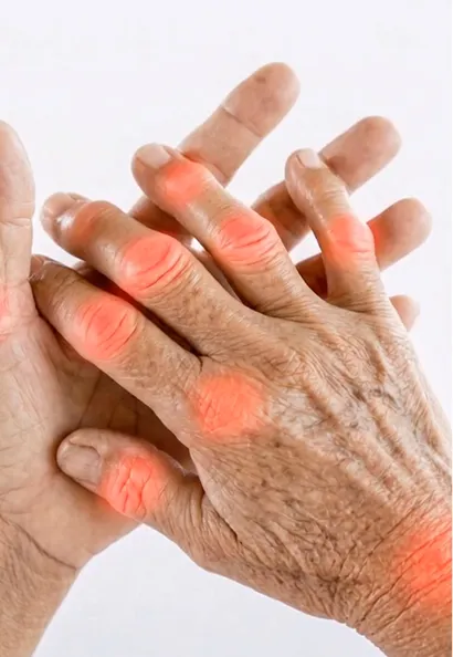 Finger joints